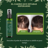 🌿 OUHOE – CRECIMIENTO DE CABELLO