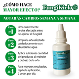 GOTAS CONTRA HONGOS DE LAS UÑAS